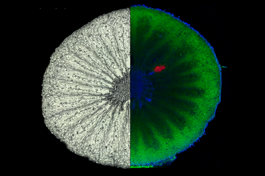 Bildgebende Massenspektrometrie (MS imaging) macht Inhaltsstoffe in Kiwifrucht sichtbar